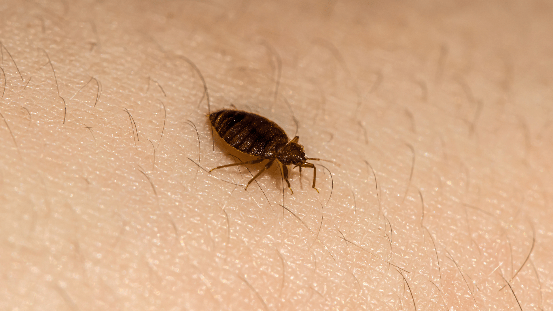 Are bed bugs black? This macro photo shows a bed bug's true dark brown coloration as it crawls across human skin