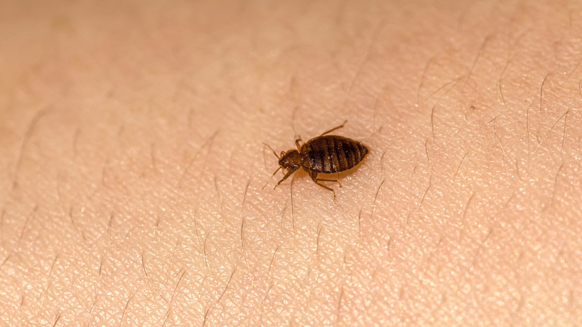 Detailed photo of a single bed bug on human skin, highlighting why many residents choose to exterminate bed bugs in Dallas to prevent bites and infestations.