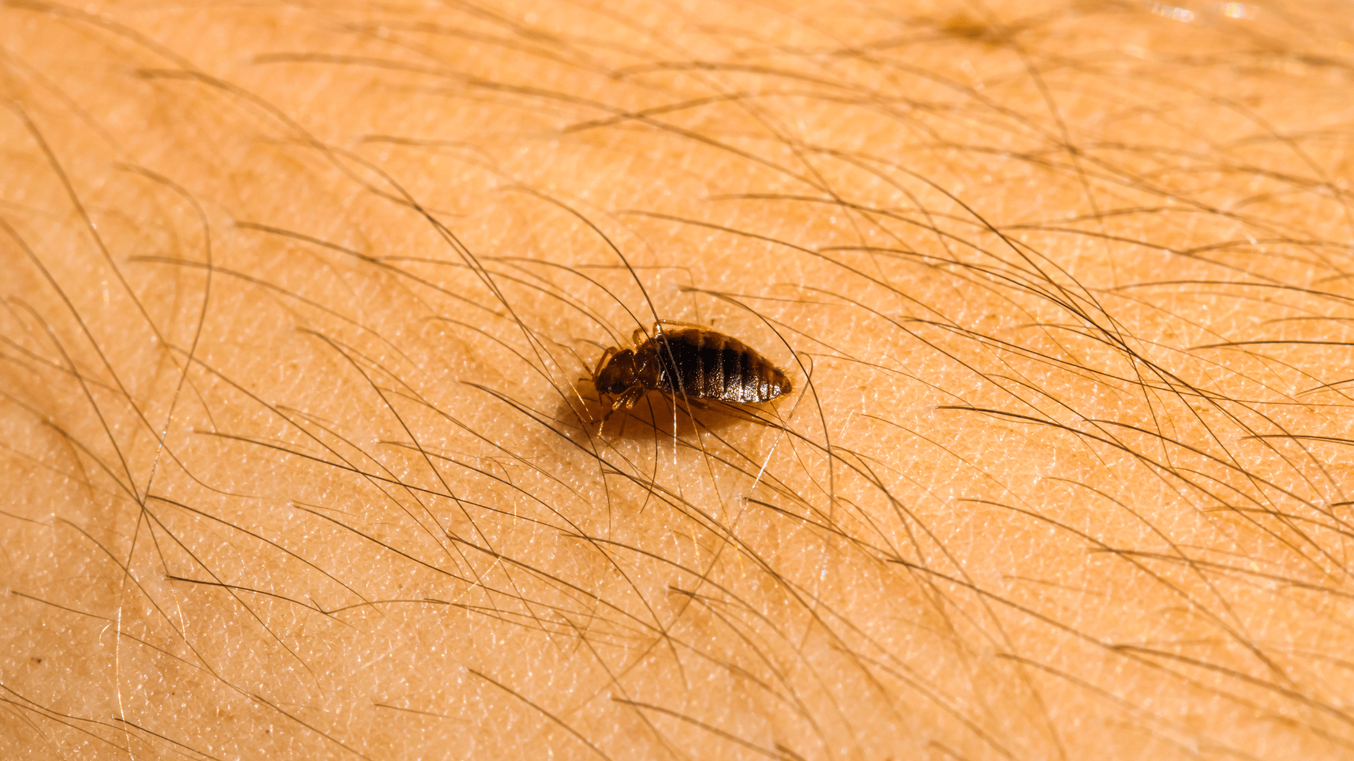 Adult bed bug crawling on human skin, demonstrating why bed bug treatment services are essential for eliminating these parasitic pests